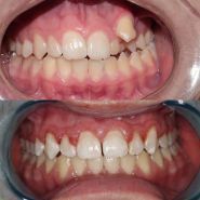 O Dent, стоматологія фото