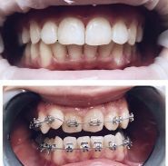 Майстер Дент, стоматологія фото