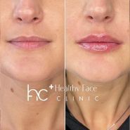 Healthy Face Clinic, клиника здоровой красоты фото
