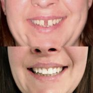 Impress, ортодонтична клініка фото