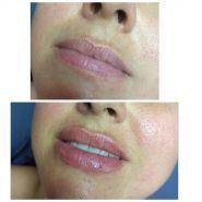 Косметолог Тетяна Мірошниченко фото