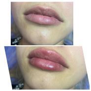 Косметолог Тетяна Мірошниченко фото