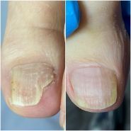 Подолог Тетяна Кущева фото