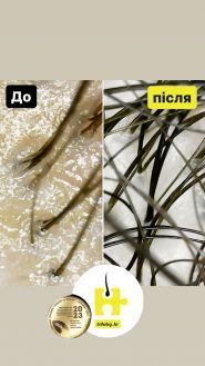 Марія Стеблина, медичний трихолог фото