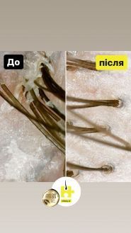 Марія Стеблина, медичний трихолог фото