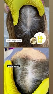 Марія Стеблина, медичний трихолог фото