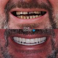 Your Dentist+, стоматологія фото