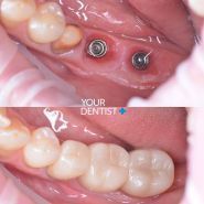 Your Dentist+, стоматологія фото