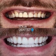 Your Dentist+, стоматологія фото