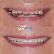 Your Dentist+, стоматологія фото