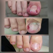 Щекотливая тема, центр подології фото