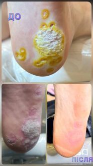 Щекотливая тема, центр подології фото