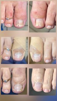 Щекотливая тема, центр подології фото