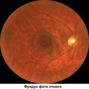 Оптикон, медичний центр та оптика фото