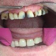 ОЗ, стоматологія фото