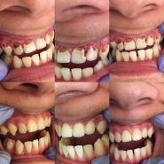 ОЗ, стоматологія фото