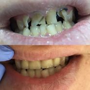 ОЗ, стоматологія фото