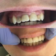 ОЗ, стоматологія фото