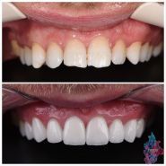 Tipster dental clinic, стоматолог фото