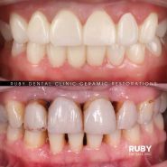 Ruby Dental Clinic, стоматологічна клініка Кухаревича Олексія Віталійовича фото