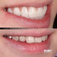 Ruby Dental Clinic, стоматологічна клініка Кухаревича Олексія Віталійовича фото
