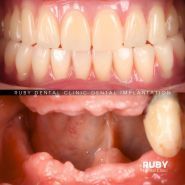 Ruby Dental Clinic, стоматологічна клініка Кухаревича Олексія Віталійовича фото