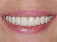 Odontosfera, стоматологія фото