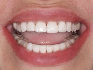 Odontosfera, стоматологія фото