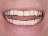 Odontosfera, стоматология фото