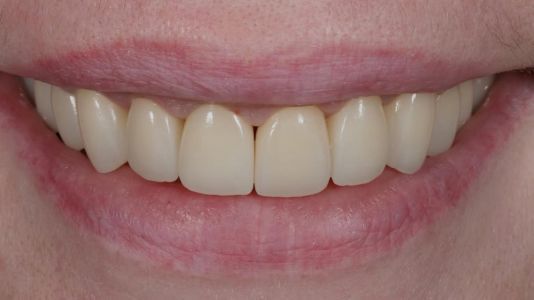 Відгуки про “Стоматологічний кабінет Сови Наталії” - фото 2