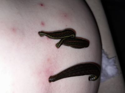 Відгуки про “Будинок здоров'я, медичний центр” - фото 2