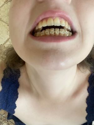 Відгуки про “Дентал Естетік, стоматологія” - фото 2