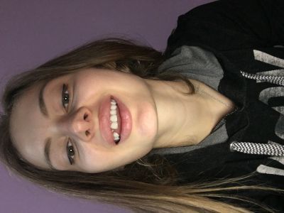 Відгуки про “Dr.Polonsky, стоматологія” - фото 2