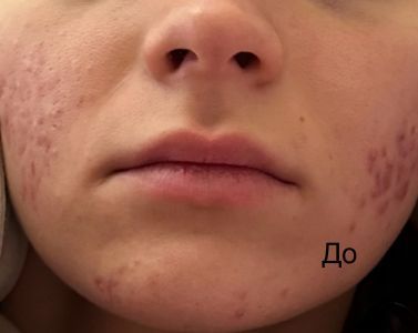 Відгуки про “Beauty Art, центр пластичної хірургії” - фото 2