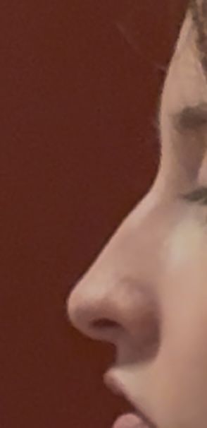 Відгуки про “Лор, клініка Стахіва” - фото 2