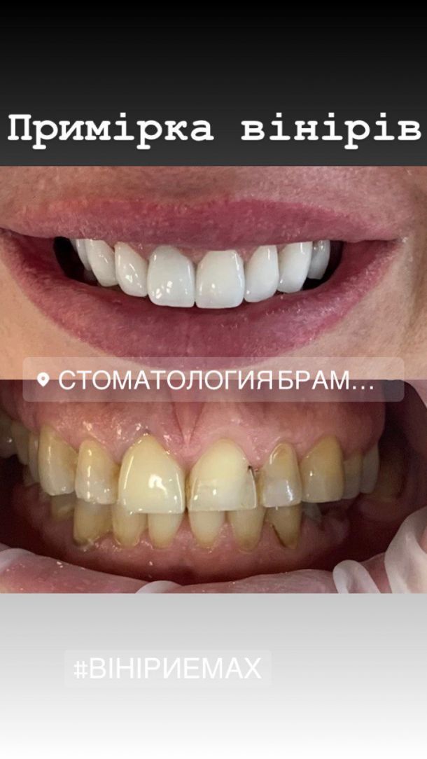 Відгуки про “Брамадент, стоматологія” - фото 1