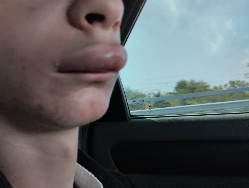 Відгуки про “Світ, стоматологія” - фото 1