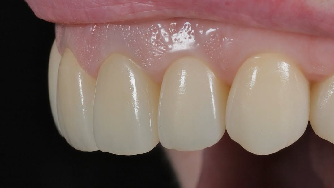 Відгуки про “Стоматологічний кабінет Сови Наталії” - фото 1