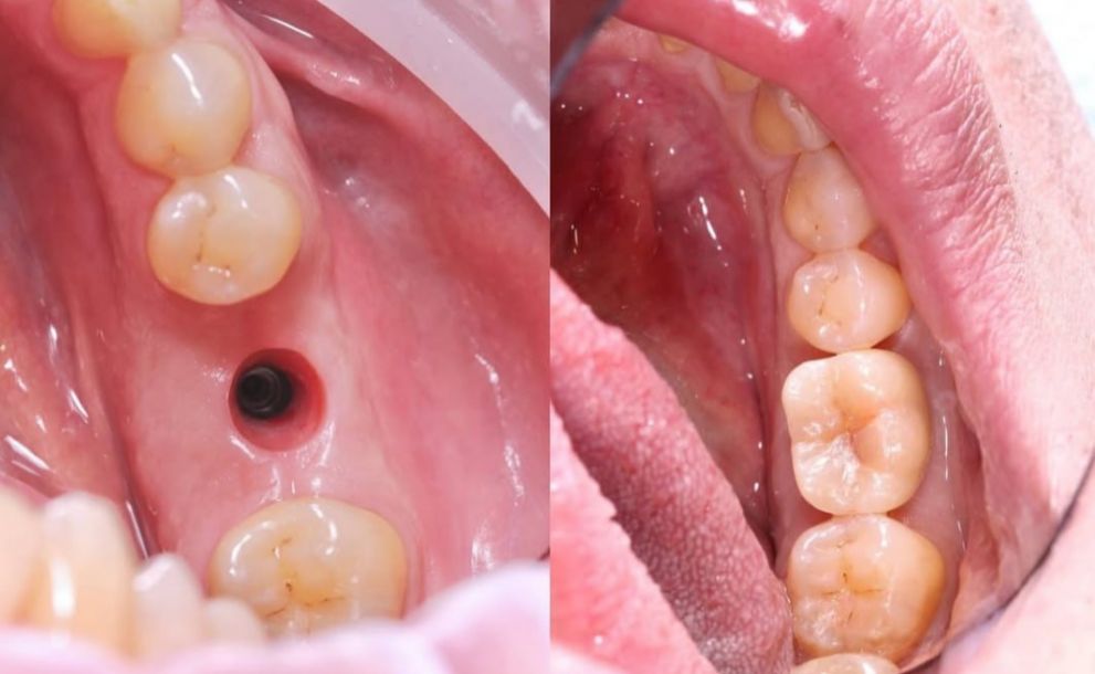 Відгуки про “Стоматологічний кабінет Сови Наталії” - фото 1