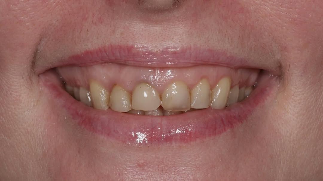 Відгуки про “Стоматологічний кабінет Сови Наталії” - фото 1