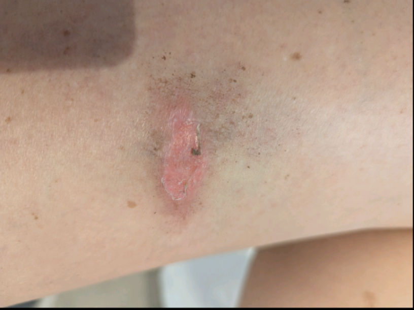 Відгуки про “Tk laser, лазерна епіляція” - фото 1