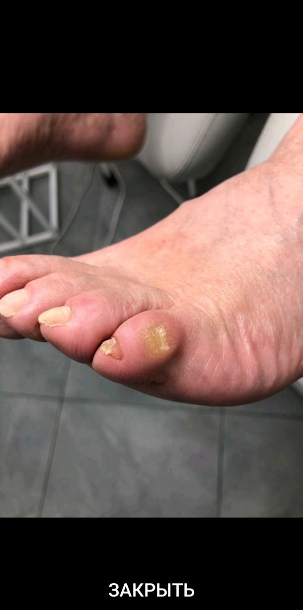 Отзывы о “PodoPlex, центр подологии” - фото 2