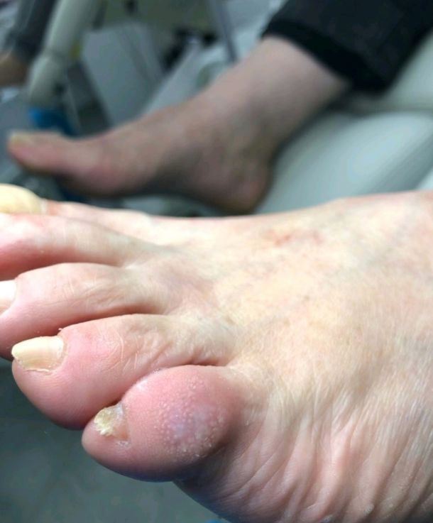 Отзывы о “PodoPlex, центр подологии” - фото 1