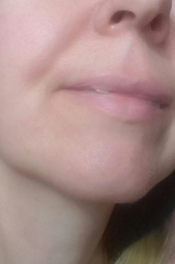 Відгуки про “Наталія Черкашина, стоматолог” - фото 1