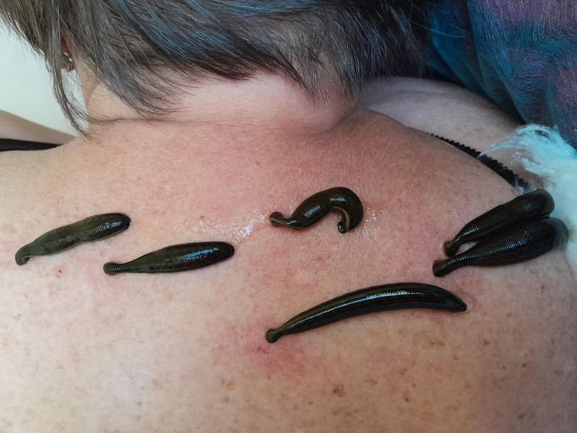 Відгуки про “Будинок здоров'я, медичний центр” - фото 1