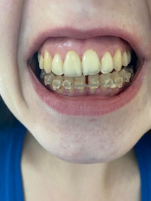 Відгуки про “Дентал Естетік, стоматологія” - фото 1