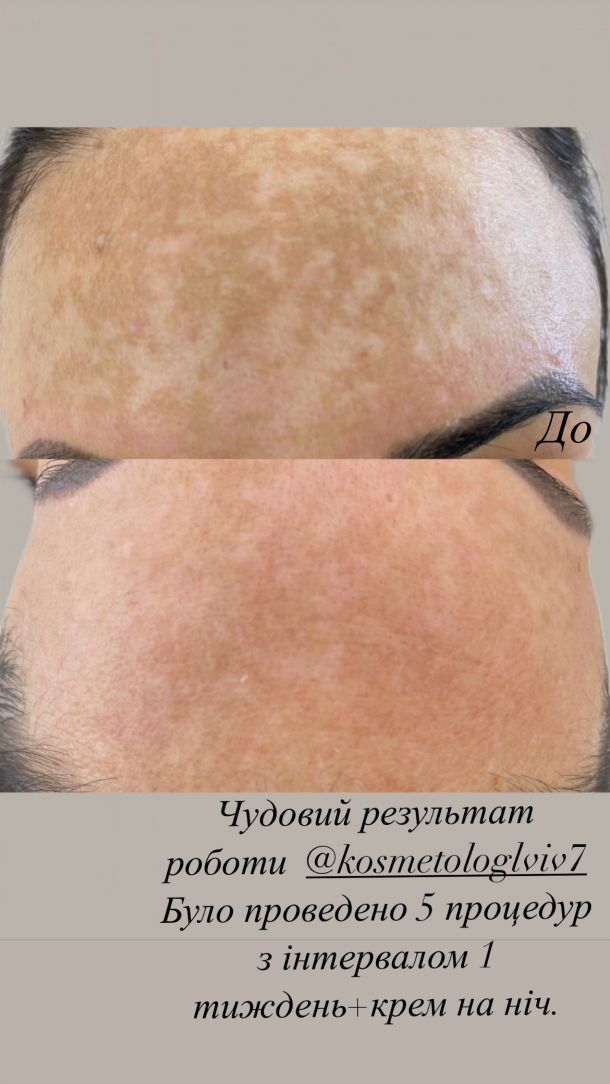 Відгуки про “Flat Laser, косметологія, лазерна епіляція, кріоліполіз” - фото 1