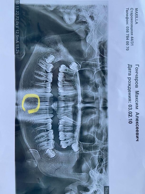 Відгуки про “StomaParadise, стоматологія” - фото 1