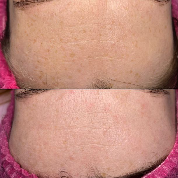 Відгуки про “Lazer Beauty, лазерна епіляція” - фото 1