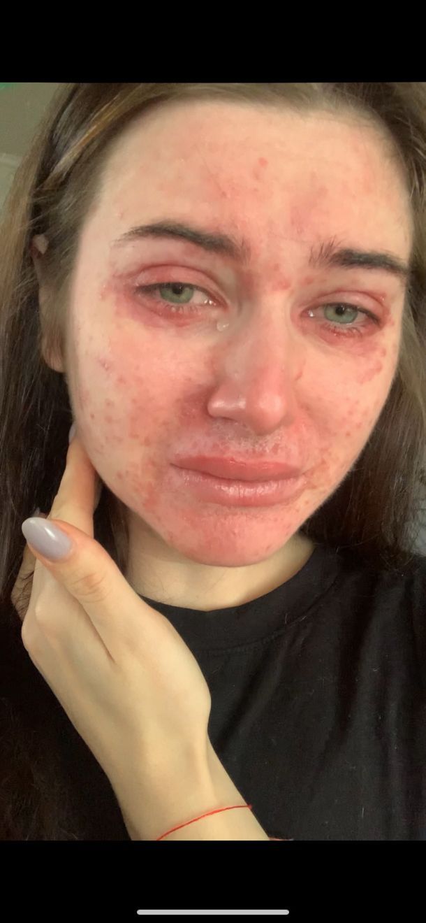 Отзывы о “Happy Woman, лечебная косметология Инны Назарчук” - фото 1